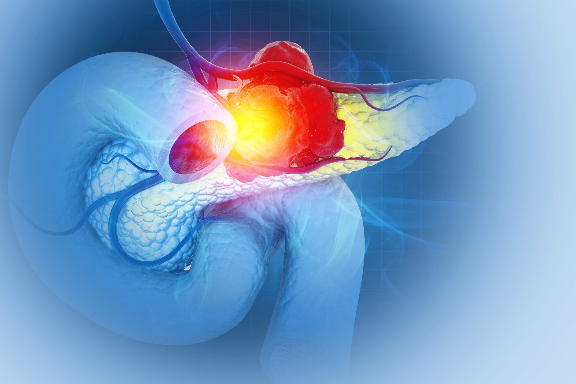 Researchers From ChristianaCare and The Wistar Institute Identify Promising New Therapeutic Target for Pancreatic Cancer